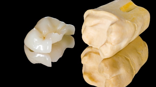 Metal free dental restoration used to repair model of damaged tooth