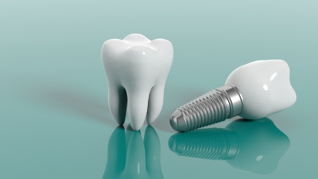 Model tooth and dental implant supported dental crown